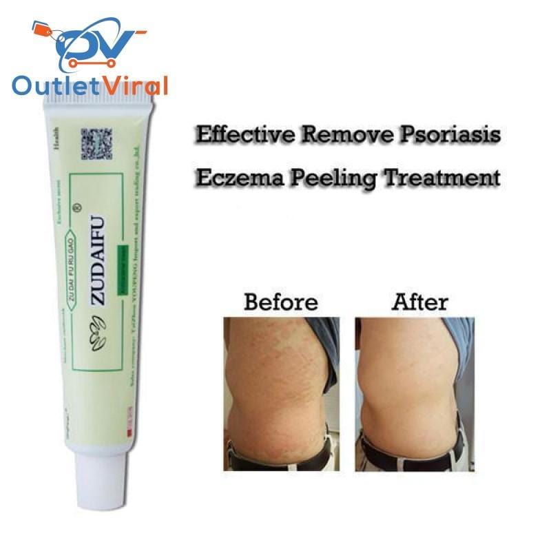 Advanced Psoriasis & Eczema Cream 1Pc